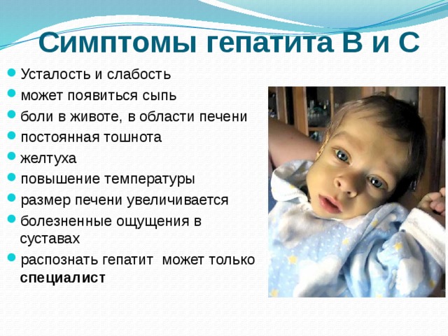 Гепатит С у детей как проявляется заболевание, лечение, прогнозы