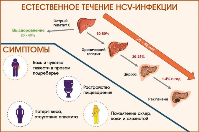 Как подобрать эффективный курс лечения гепатита С