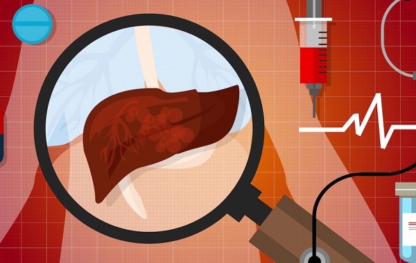 Токсический гепатит печени