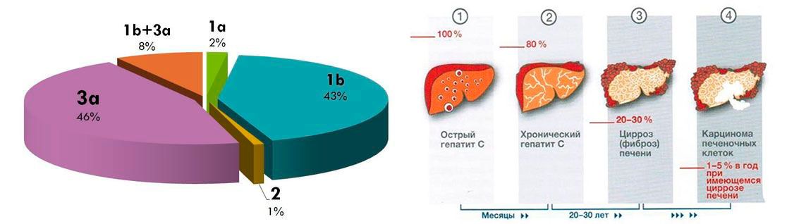 Гепатит C генотип 1b