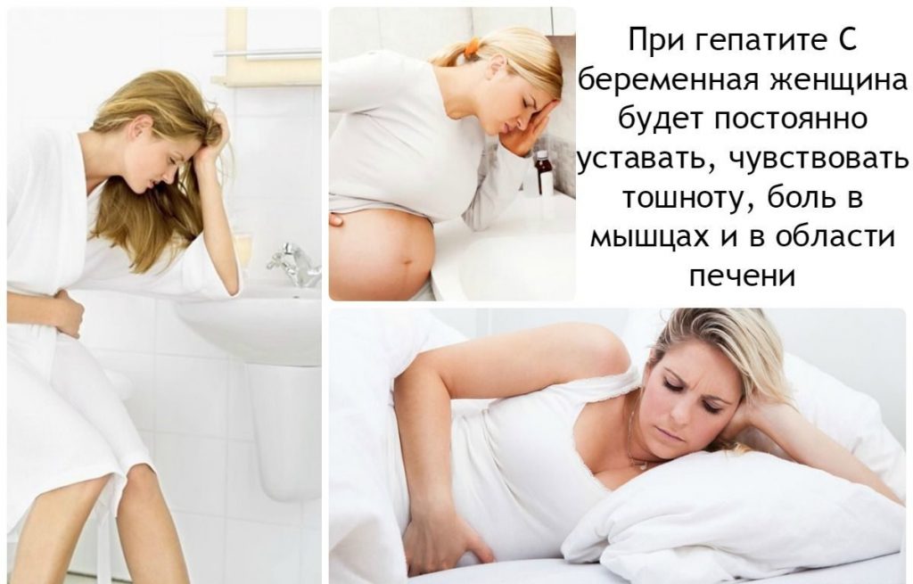 Что делать, если обнаружен вирус гепатита С при беременности. Можно ли родить здорового ребенка