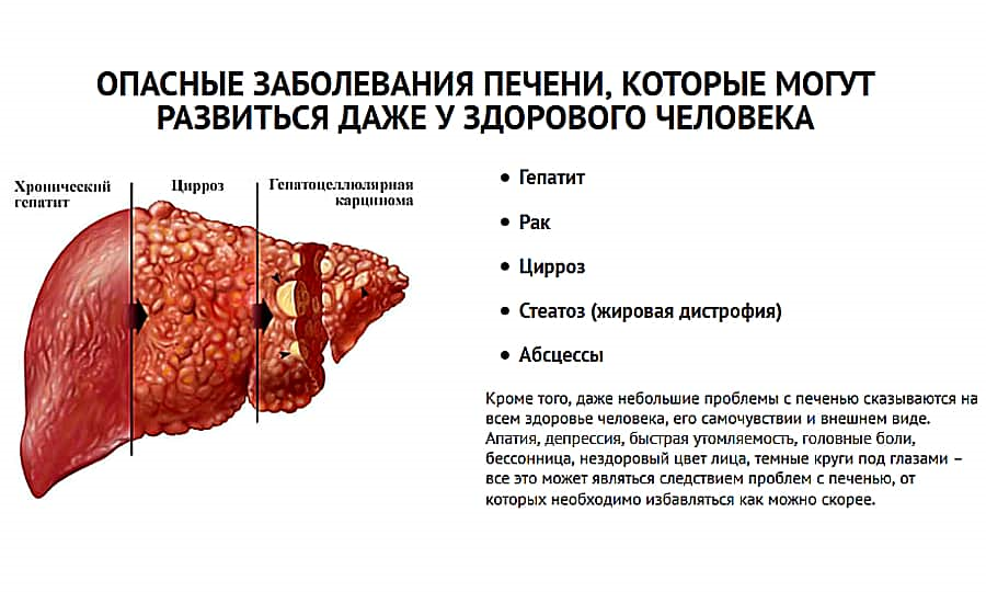 Можно ли вылечить полностью и навсегда гепатит С